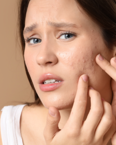 conseils Melody Molins alerte petits boutons