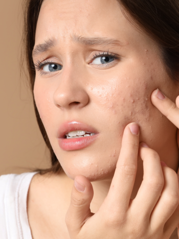 conseils Melody Molins alerte petits boutons